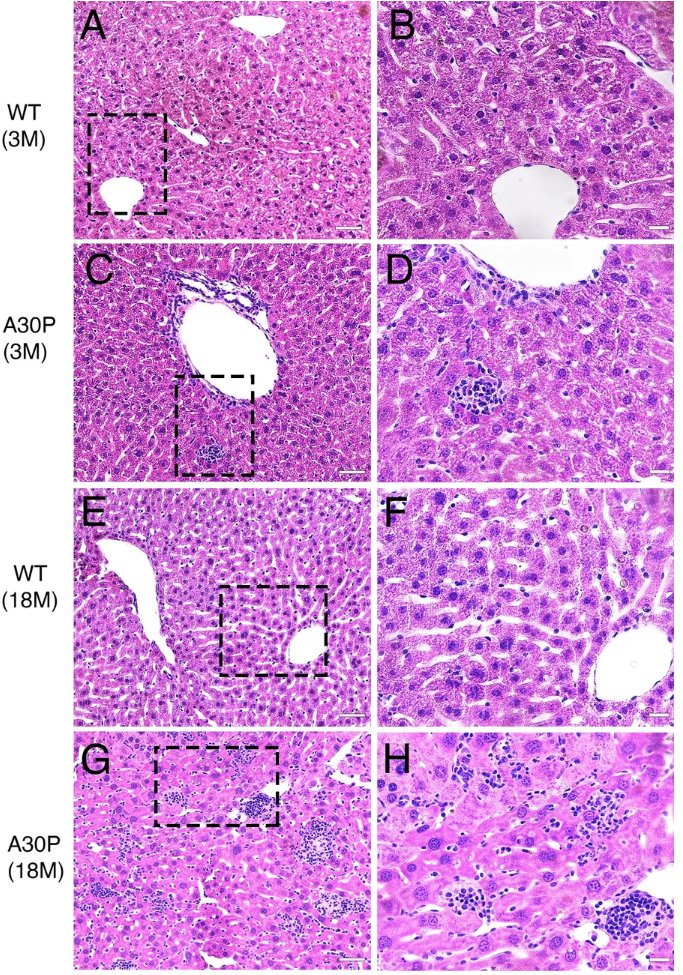 New research from <a href="/HallbeckMartin/">Martin Hallbeck</a> <a href="/HallbeckLab/">Hallbeck Lab</a> &amp; colleagues explores accumulation of #Parkinsons-associated alpha-synuclein within the liver (the main organ responsible for substance clearance &amp; detoxification); Human + 3 transgenic mouse samples involved
actaneurocomms.biomedcentral.com/articles/10.11…