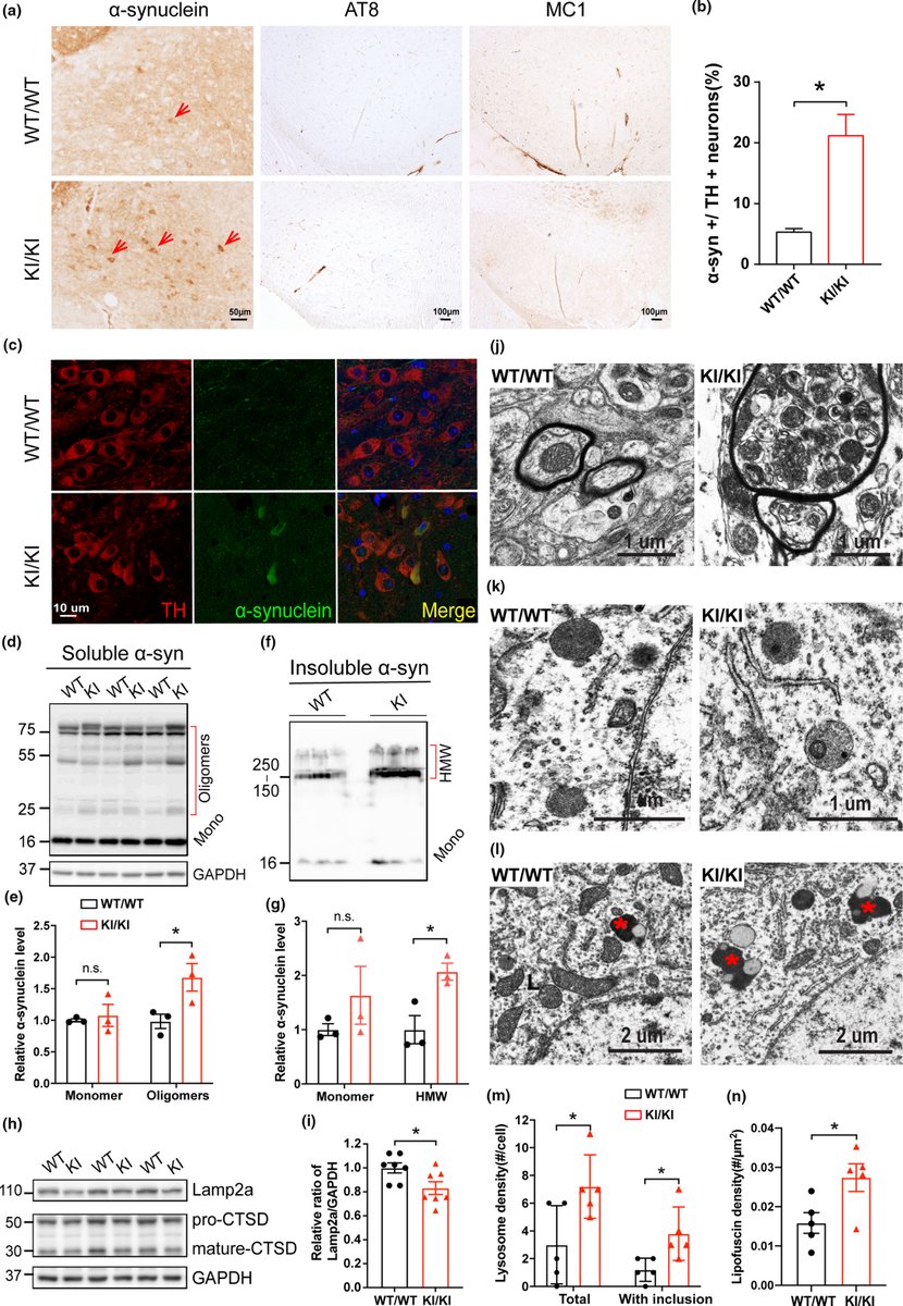 Mice carrying VPS35 D620N variant (which involves mitochondrial fragmentation &amp; dysfunction) present some features of #Parkinsons at 14 months of age (progressive motor deficits, loss of the DA neurons, neuroinflammation, &amp; accumulation of α‐synuclein
onlinelibrary.wiley.com/doi/10.1111/ac…