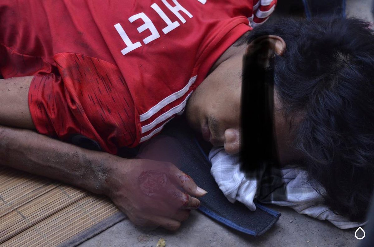 ofmirae's tweet photo. Tw // wound // blood
In Mandalay between 56 -57 street, a civilian was seriously injured by the raid of the military Junta.
STRENGTH OF UNITY 
#WhatsHappeningInMyanmar 
#Mar22Coup https://t.co/wSxM4vCQcf