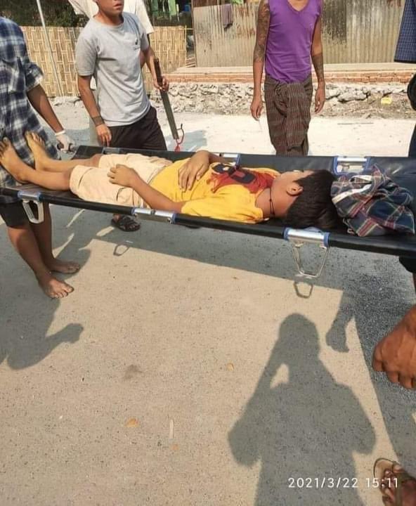 မန္တလေးမြို့ရှိ မြရည်နန္ဒာတိုက်ခန်းများအနီး ပစ်ခတ်မှုကြောင့် ၁၃နှစ်အရွယ်ကလေးငယ် ထိမှန်ကျဆုံးခဲ့ TW// Blood 
#WhatIsHappeningInMyanmar #HearTheVoiceOfMyanmar
 #Mandaly 
#Mar22Coup