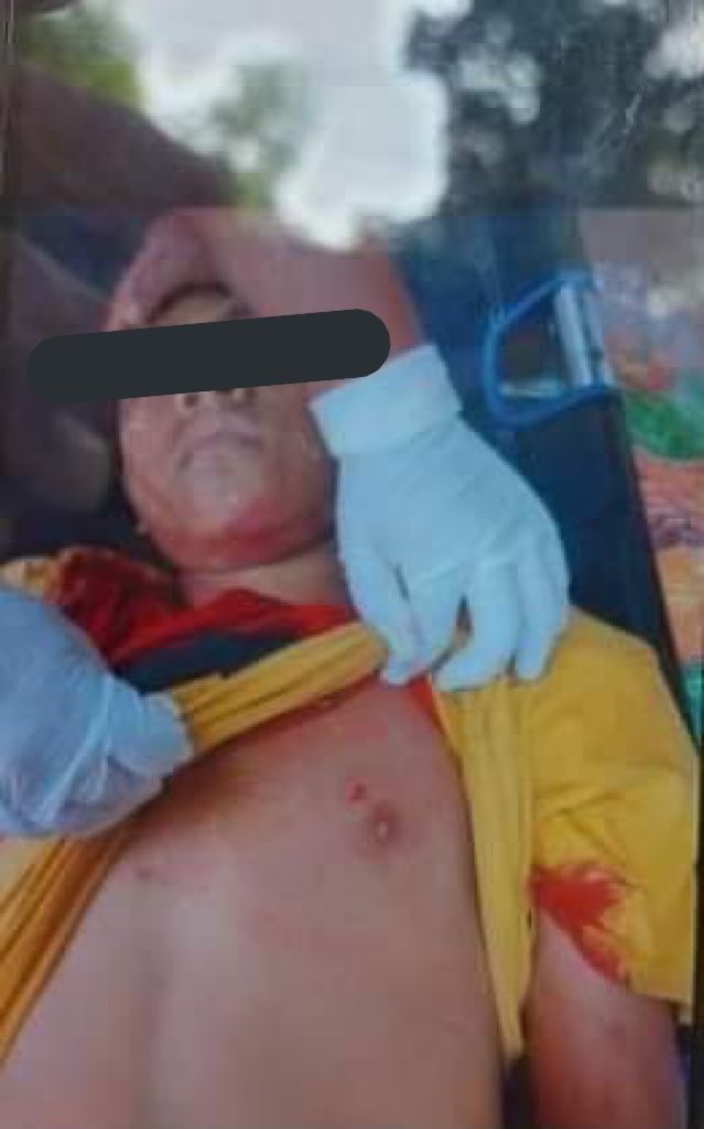 tw // death , 
13 years old boy who got shot in the chest with live ammunition in Mya Yee Nandar Housing, Mandalay. He wasn’t even protesting,he was just sitting. An innocent child has lost his life because of terrorists. #WhatsHappeningInMyanmar #Mar22Coup
