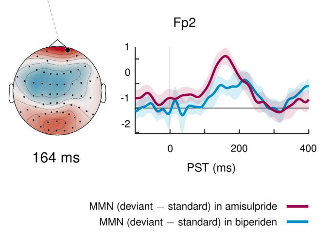 lilwebian's tweet photo. We find that #biperiden, which antagonizes muscarinic ACh receptors, shifts the MMN peak in time &amp; sensor space - in contrast to #amisulpride (antagonizing DA receptors). This supports a differential sensitivity of the MMN to the two modulators.

5/n https://t.co/3up9e4VmsX