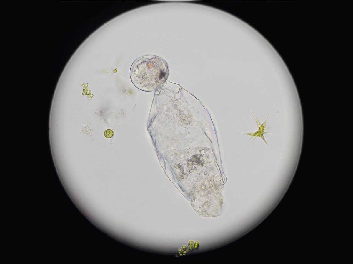 kakogawa_hedin's tweet image. このワムシはすでに死んでしまっていますが、卵の中の赤ちゃんワムシはまだ生きていて、何やらうごめいているのがわかります。

無事に生まれるのかな？😊

（KN-100TC Plan40×＋DMC-GF6）

#顕微鏡
#ワムシ