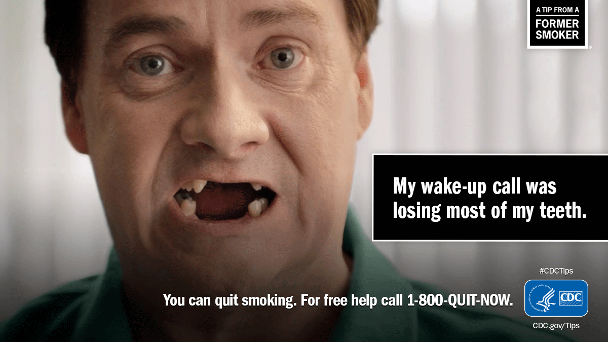 Brett P. lost most of his teeth by the time he was 42 because he had gum disease from smoking. #CDCTips
Link: go.usa.gov/xsTXn