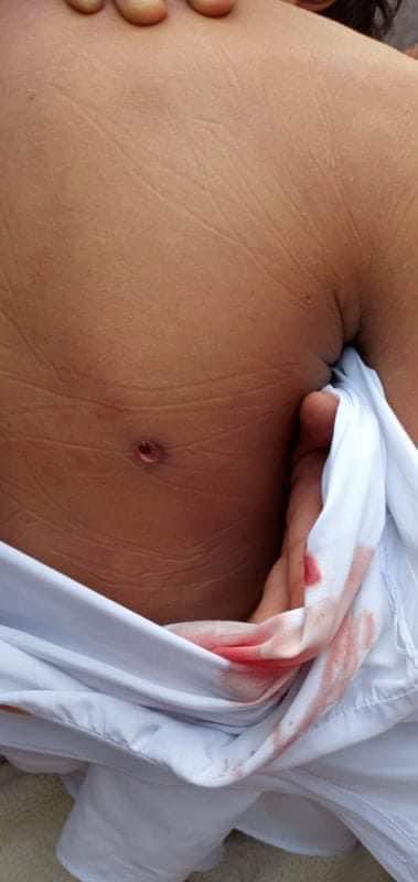badiucao's tweet photo. A 13 year old was killed today by military junta at home in Myanmar.
the wound is so small, 
but it took his life
The small wound turns a huge hole tearing his mum’s heart. It never heals.

Silence from the free world is another bullet.
#SaveMyanmar
#WhatsHappeningInMyanmar https://t.co/DOwO2sBM04