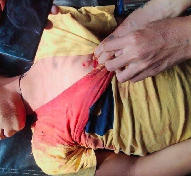 badiucao's tweet photo. A 13 year old was killed today by military junta at home in Myanmar.
the wound is so small, 
but it took his life
The small wound turns a huge hole tearing his mum’s heart. It never heals.

Silence from the free world is another bullet.
#SaveMyanmar
#WhatsHappeningInMyanmar https://t.co/DOwO2sBM04