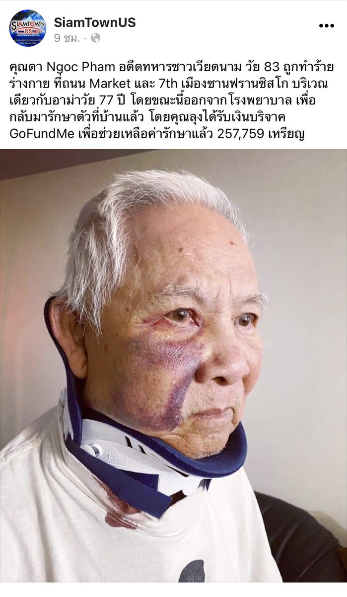 โคตรโหด การเหยียดคนเอเชียรุนแรงขึ้นเรื่อยๆ ทั้งอาม่า ทั้งชายชาวฟิลิปปินส์ ถูกตีจากด้านหลัง มีเลือดออกในตา ขนาดล้มก็ยังโดนอีก คุณตาชาวเวียตนามวัย83ถูกทำร้ายที่เดียวกันกับอาม่า หน้าเขียวช้ำ คอใส่เฝือก ลองคิดดูถ้าเป็นพ่อแม่เราอ่ะ #StopAsianHate
#StopAsianHateCrimes
#ApologizeToUs