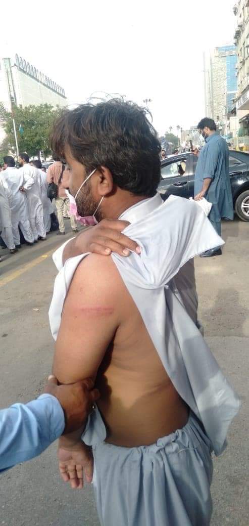 GoharMemon's tweet photo. This is how @MediaCellPPP has dealt with the educated lot of Sindh. The IBA-qualifued Headmasters/Headmistresses have been baton-charged by the Police 4 demanding regularisation of their jobs. Those beaten include more than 50 Phds and a hundred M.phil. scholars! https://t.co/x1qp3iIwUl