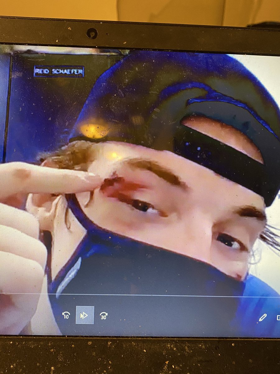 AndyEide's tweet photo. Learn how Matthew Rempe’s face got this way along with other takeaways from the Thunderbirds weekend of hockey:

https://t.co/rJegQrs239 https://t.co/VC6ZO6xrEx