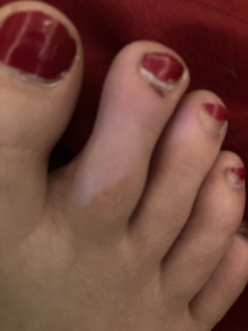 @PhillJr2 I dropped a jar of pickles on my toe... it hurts... kiss it and make it better??? https://t<a class="tags" target="_blank" title="On Twitter" href="/?out=eyJ0eXAiOiJKV1QiLCJhbGciOiJIUzUxMiJ9.eyJpYXQiOjE3MjU4ODQwOTQsImlzcyI6InR3cG9ybnN0YXJzLmNvbSIsIm5iZiI6MTcyNTg4NDA5NCwiZXhwIjoxNzU3NDIwMDk0LCJyZWRpcmVjdF91cmwiOiJodHRwczovL3R3aXR0ZXIuY29tL1BoaWxsSnIyIn0.w6HI9T7RScK80bDMEhQYtqfhkRnHBL33SpyydegINL4kDTbKnfaI8j2BkL4EBNQNKcwC8W_IIUrcpWOBEMMWUw">@PhillJr2</a><a href="/tag/booty"class="tags"><span>#booty</span></a><a href="/tag/lush"class="tags"><span>#lush</span></a><a href="/tag/hairy"class="tags"><span>#hairy</span></a><a href="/tag/tits"class="tags"><span>#tits</span></a><a href="/tag/bush"class="tags"><span>#bush</span></a><a href="/tag/pierced"class="tags"><span>#pierced</span></a><a href="/tag/noshave"class="tags"><span>#noshave</span></a>