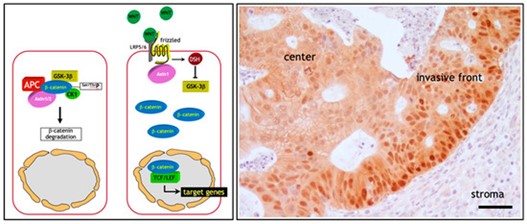 Cancers_MDPI's tweet photo. 💠"Cell Heterogeneity and Phenotypic Plasticity in Metastasis Formation: The Case of #Colon #Cancer 
👥by Miriam Teeuwssen and Riccardo Fodde (@RiccardoFodde)
👉https://t.co/imEjNvYjdn
#tumor_heterogeneity @erasmusmcintl https://t.co/ahEYuBzUtu