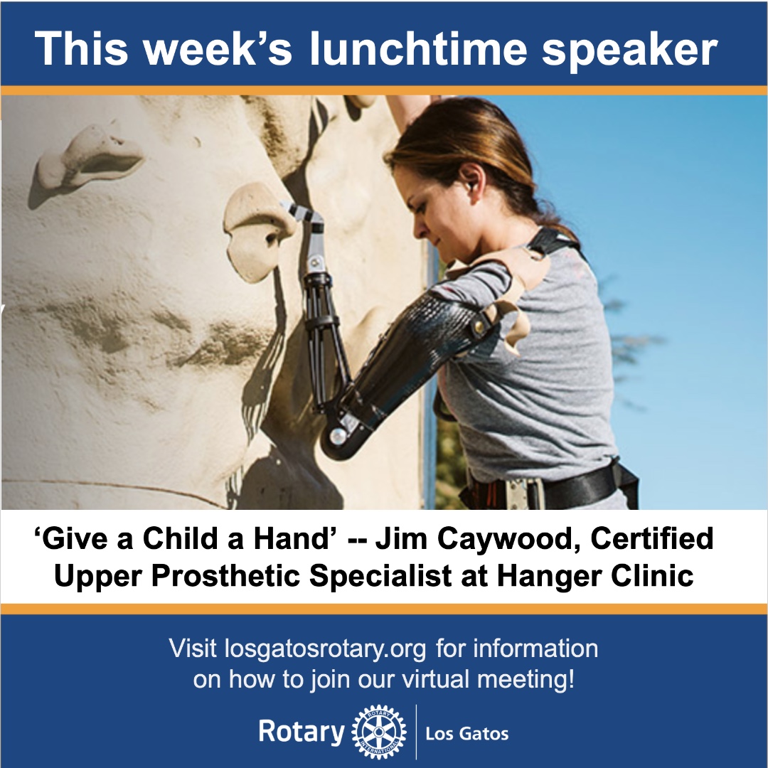 "give a child a hand"  Jim Caywood  will discuss The Myoelectric Limb Project which provides prosthetics to children born without an upper limb. Guests are welcome #rotaryguestspeaker #Myoelectriclimbproject #saratogainnerwheel #hangerclinic