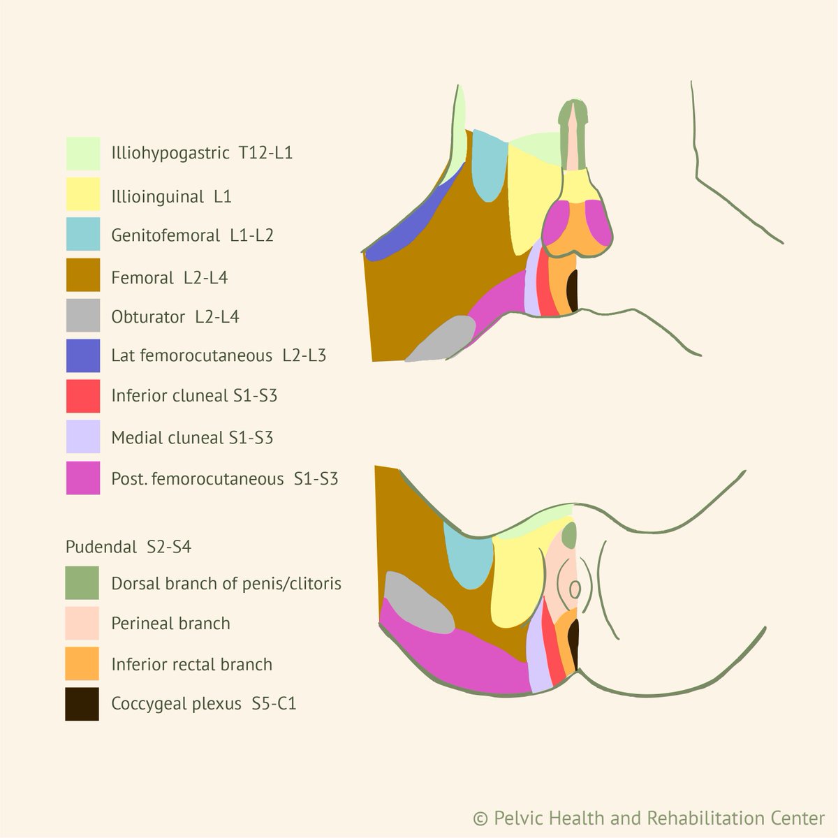 PelvicHealth's tweet photo. Too often, all #pain w/sitting gets called #PudendalNeuralgia. While the pudendal nerve is a big deal, many w #pelvicpain have pain at or outside of the ischial tuberosities &amp; this is NOT pudendal neuralgia, therefore, a pudendal nerve block will likely not be therapeutic🧵 https://t.co/IODBdAQKUF