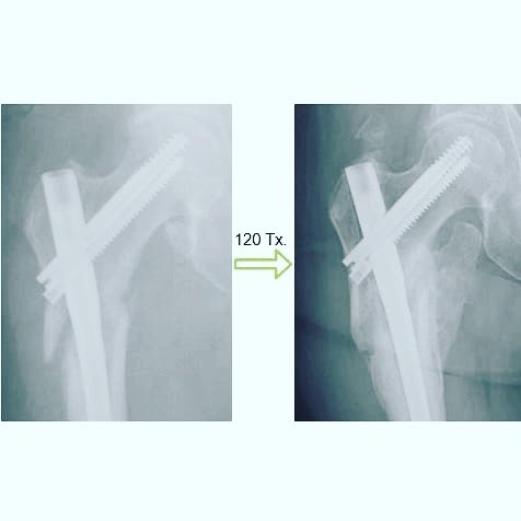 SD Trauma tweet media