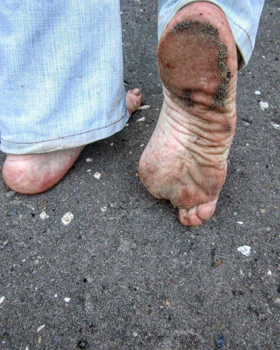 DemianaOlga's tweet photo. My old photo
  Feet in summerm  love it
 #dirtyfeetgirls #dirtyfeet #dirtyfeetarehappyfeet #dirtyfeet👣 #dirtyfeethappyheart #dirtyfeetnation ,##barefoot #barefeet #barefootgirl #barefoot #barefooted #barefeetfetish #barefootcitywalk #footfetishcommunity #footfetishnation # https://t.co/v9q4pLOki8