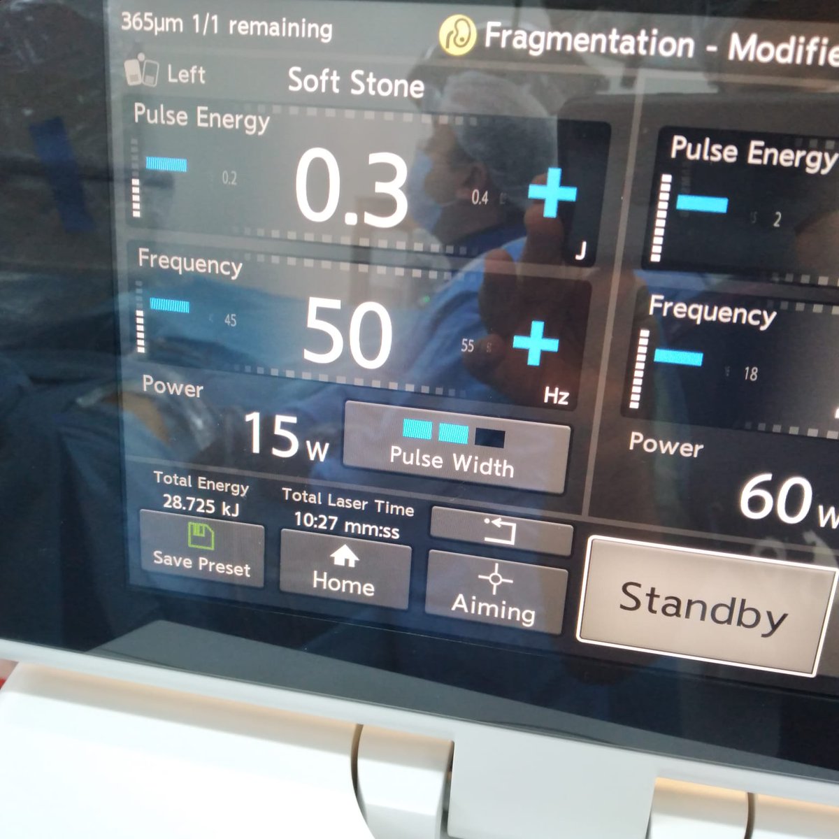 ytanidir's tweet photo. Finally, we also had the chance to test Soltive 60 Watt #TmFiber from @OlympusUrology in @MarmaraUroloji
Two complex stone case were operated successfully.
Satisfiying results achieved, especially with fine dusting & best was to use a 150 micron fibre with 400 Hz frequency. https://t.co/Dn7LEXldor