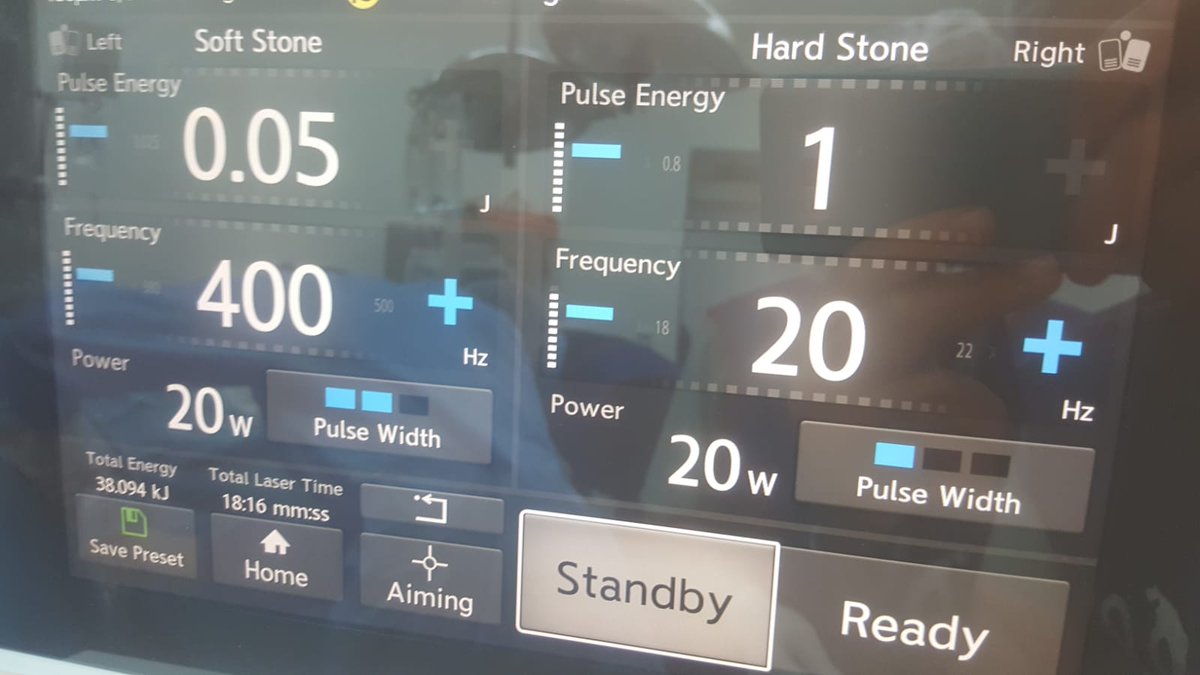 ytanidir's tweet photo. Finally, we also had the chance to test Soltive 60 Watt #TmFiber from @OlympusUrology in @MarmaraUroloji
Two complex stone case were operated successfully.
Satisfiying results achieved, especially with fine dusting & best was to use a 150 micron fibre with 400 Hz frequency. https://t.co/Dn7LEXldor