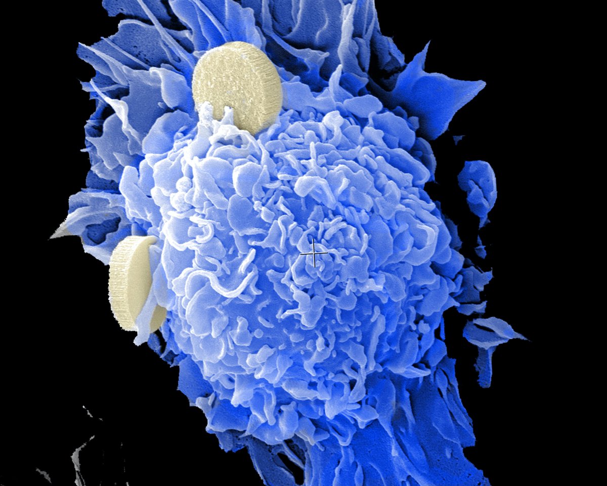 maanow's tweet photo. Every day, mathematics is used to address some of the world's toughest problems. Read more about Dr. Noble and Dr. Viossat, who are using mathematical models to tackle cancer regrowth and improve #cancertreatment. https://t.co/Kn0mvQYbfd #cancerresearch https://t.co/hUGeVLPE6O