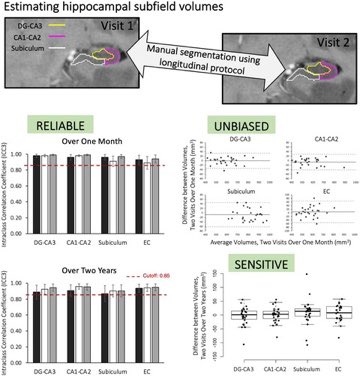 JNeurosciRes's tweet photo. New research in JNR by @RoyaHomayouni & colleagues establishes high test-retest reliability of tracing hippocampal subfield volumes in a developmental sample, using high‐resolution PD‐TSE‐T2‐weighted MR images. Check it out! https://t.co/YVTexGwrT0 https://t.co/p8NBvgdJ83