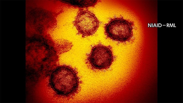 livedoornews's tweet photo. 【新型コロナ】東京都で新たに337人の感染を確認
https://t.co/PeEON97bCt

直近7日間の新規感染者数の平均は、前の週と比べて106.6%。重症者は前の日から5人減って42人となった。 https://t.co/KuWda86iOr