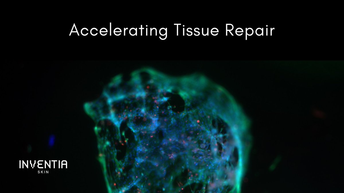 From the Latin word ‘to bind,’ Ligō platform helps treat skin trauma by rapidly delivering patient's skin cells to the wound site to initiate regeneration and accelerate tissue repair

#skinregeneration #scienceandtechnology #innovation #biotechnology #healthcare #research