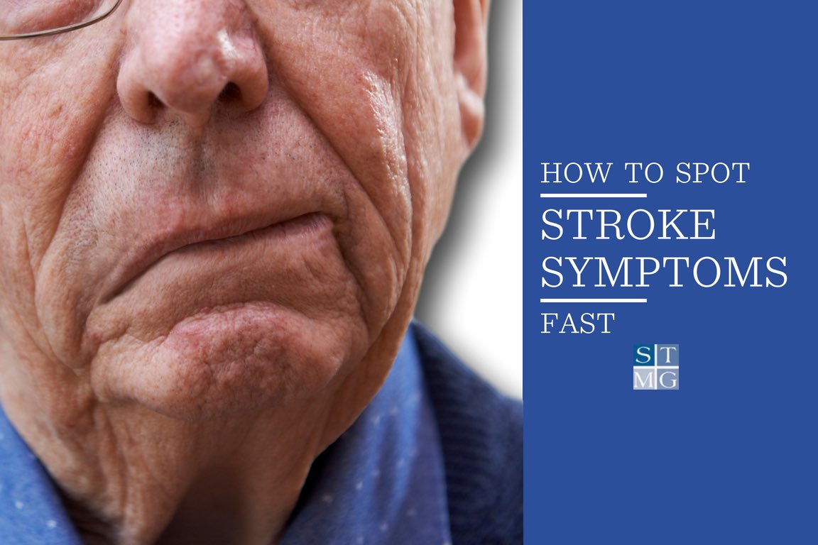 OurFavOnlineDoc's tweet photo. If you are with someone,

And they SUDDENLY:
Cannot talk clearly
Cannot smile/move one side of face,
Cannot lift an arm/leg,
Cannot close one side of mouth,

This is NOT spiritual arrow,
That is STROKE.

Go to hospital NOW.
Or they will be paralysed for life.

Pls RT Save a life. https://t.co/PllO8KxKUP