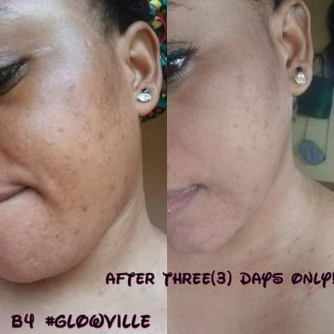 Glowville77's tweet photo. Get your Amazing #GlowVille natural skincare, hand-made in small batches to maintain utmost quality, made from fresh fruits, plants &amp; natural oils.
For treatment of all skin blemishes (pimples, dark spots, &amp;sun burn etc), for skin protection &amp; nourishment.
@sexy_oma_ https://t.co/Qwhpkx4QBT
