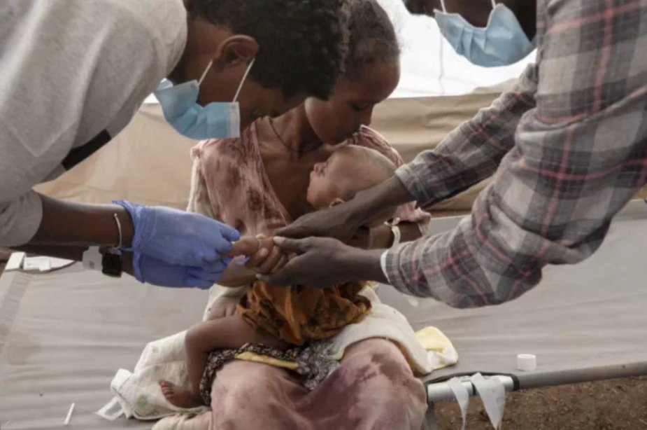 GerrySimpsonHRW's tweet photo. After months of #Ethiopia blocking aid to #Tigray, UN says new assessments show "very high proportion of kids under 5 affected by acute malnutrition" &amp; "proportion of Global Acute Malnutrition based on ... Arm Circumference exceeds emergency thresholds" https://t.co/U22HJwlsW4 https://t.co/Npj0vjE6Yh