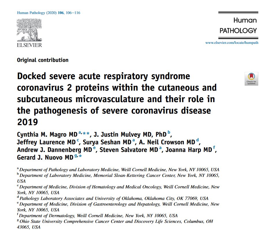 Human_Pathology's tweet photo. #MostDownloaded alert! #HumPathol
Magro et al. show that in severe #COVID19 colocalization of ACE2 & capsid proteins without viral RNA suggests that circulating viral proteins may dock onto microvascular endothelium and induce complement activation
https://t.co/iGWtuz4gJI https://t.co/bJ7UnIPp62