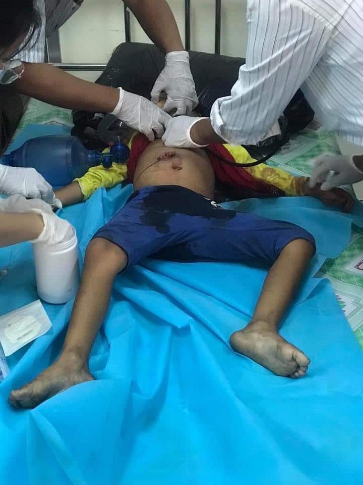 Akang72365789's tweet photo. Is there still humanity? At around 5 pm on the 23rd, a seven-year-old girl in Wacheng was shot at home. When her father sent her to a doctor, he waited nervously for a miracle, but the doctors still had nothing to do after the rescue.
#WhatsHappeningInMyanmar https://t.co/rCimJZWo1w