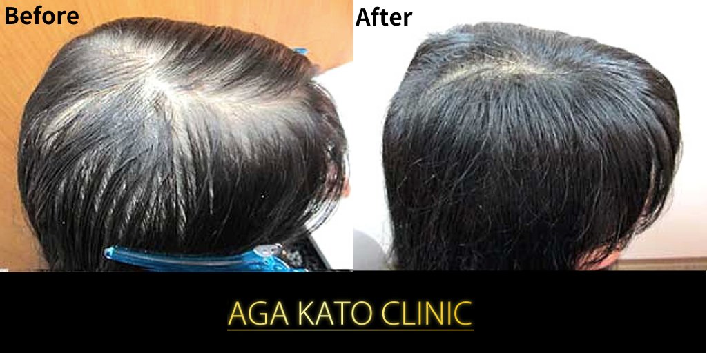 Aga加藤クリニック 大阪梅田 京都西院 Agakatoclinic Twitter