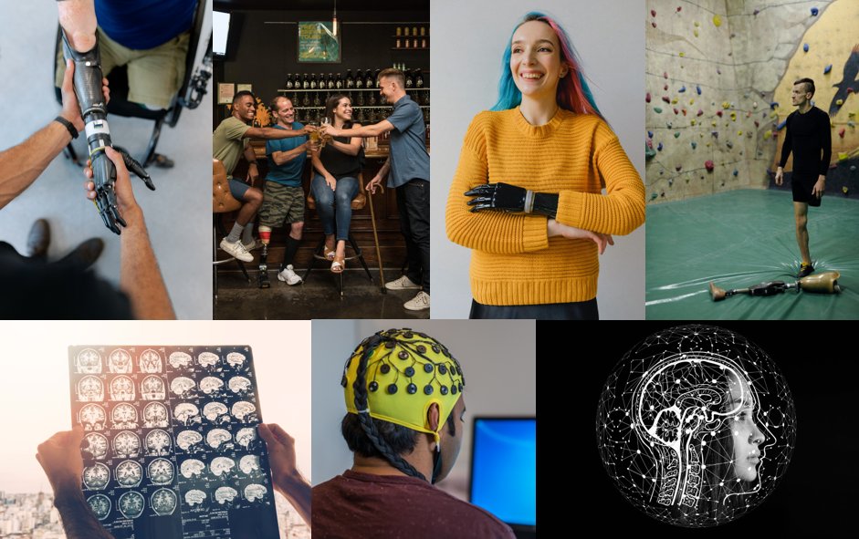 ReachCharity's tweet image. We are pleased to announce we are working with @res4limbless to study difference aspects of Limb Difference and the affects on body experiences i.e. touch perception, movement. If you can help them, their research might help us.  Please get involved. 

reach.org.uk/essex-universi…