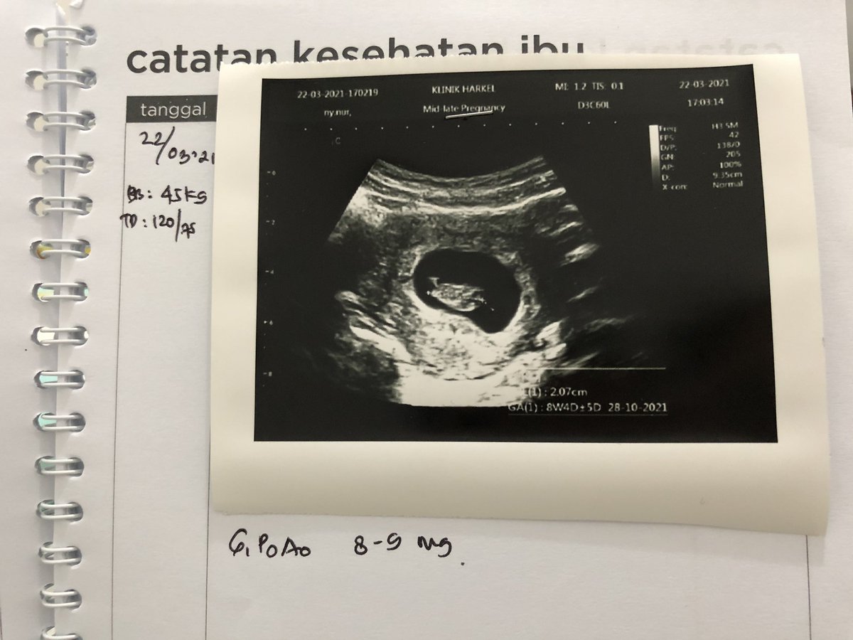 mengenalkan kaka sama dunia twitter, hallo kaka disini dunia ramah dan menyenangkan nya ayah-bunda 🙌