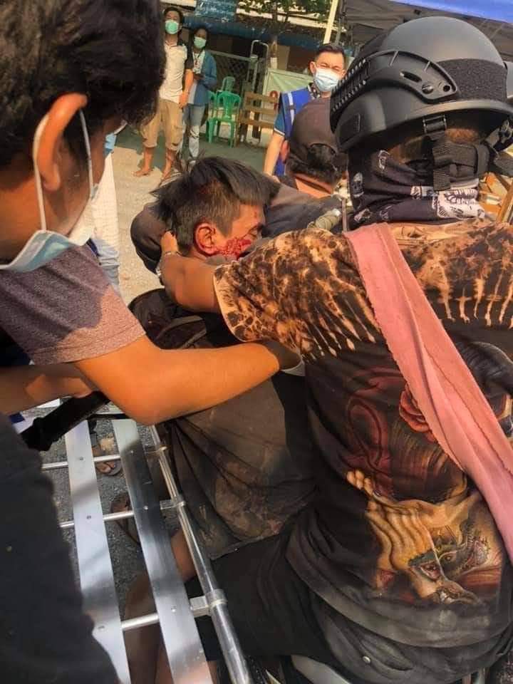SaveMyanmar01's tweet photo. Tw // Blood; Unknown 28 yro man was killed  during brutal crackdown by Junta in Mandalay. What he brought in his backpack was a piece of wood to use as a bulletproof. It was able to protect his heart but not his head.

Rest in Power 

#WhatsHappeningInMyanmar #Mar23Coup https://t.co/p6RDGo6g7Y