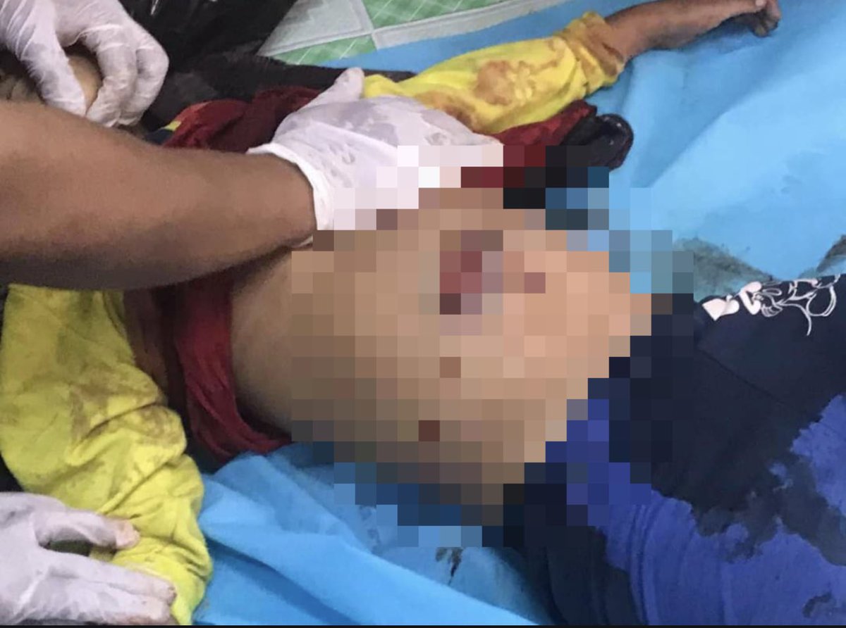 #Mar23Coup Mandalay

Child, 7, killed by SAC JUNTA soldiers entering house and shooting. 

#WhatsHappeningInMyanmar