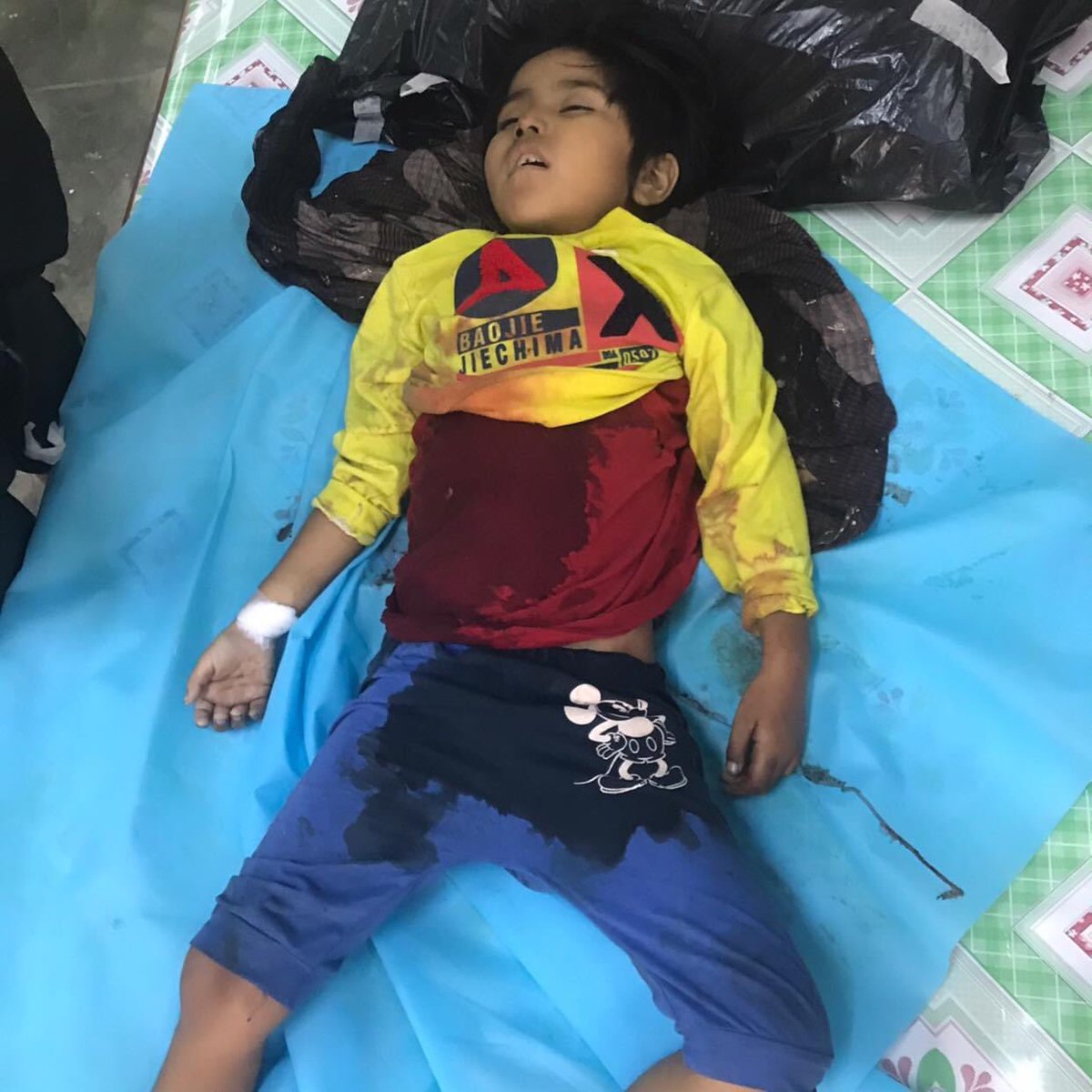 ChawSu00880278's tweet photo. TW//blood: 7 years old girl Khin Myo Chit was shot to death at her house by Terrorists soldiers.#Mandalay #SaveChildren @SRSGVAC #Mar23coup @unicefchief @SecBlinken @SchranerBurgen1 @SecBlinken https://t.co/fzXw2cOFT9