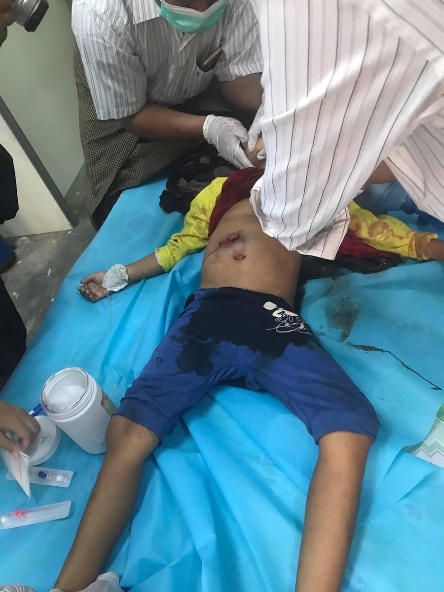 NandarA13496622's tweet photo. 🛑DEVASTATING :: 7-yr old girl was shot to death by the Military forces. Her father said he asked her to go inside while she was upstairs when the military forces raided into the ward. Yet they already shot her‼️😭
#WhatsHappeningInMyanmar #Mar23Coup 
@UNICEF @USAmbUN @freya_cole https://t.co/xxpLYpzx9j