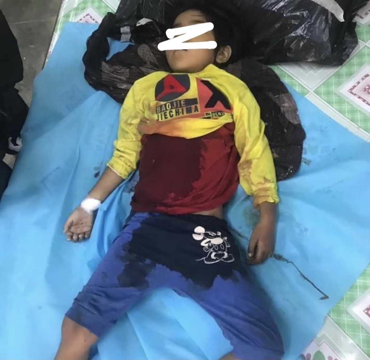 ShoonPyie's tweet photo. 7-year-old girl died of gunshot wound in the abdomen

tw//blood,death 

#MilitaryTerrorists
#WhatsHappeningInMyanmar
#March23Coup
@freya_cole @poppymcp @UN @UNinMyanmar @UN_HRC @UNHumanRights @RapporteurUn @UNICEF @SavetheChildren @USEmbassyBurma https://t.co/u7xtKWhsjI