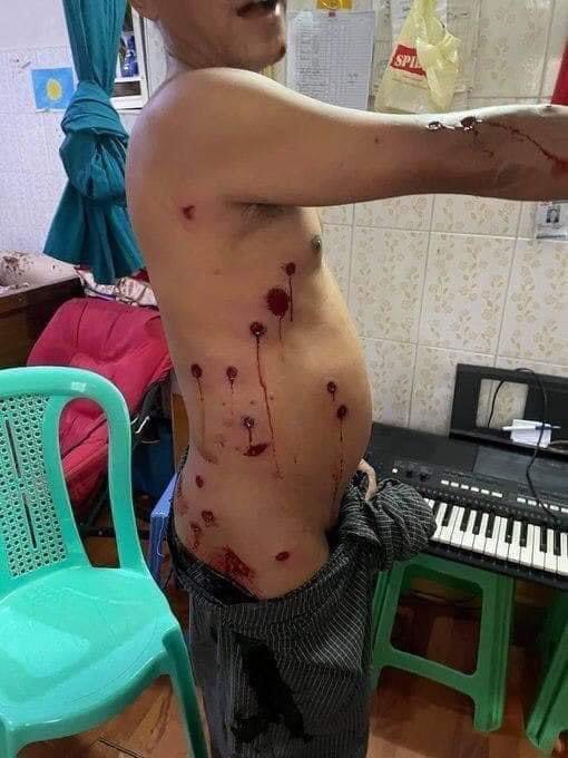 tw // blood; A man was shot almost 20 times with rubber bullet by Myanmar military today 5:30 PM in Sanchaung township, Yangon.