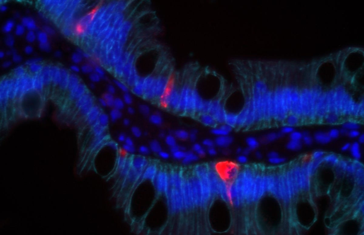 SaraDiRienzi's tweet photo. I don't know anything about this individual. But I can say their intestines are beautiful. Looking at CHGA staining in red here. #beautifulontheinside https://t.co/84dAIPf5xP