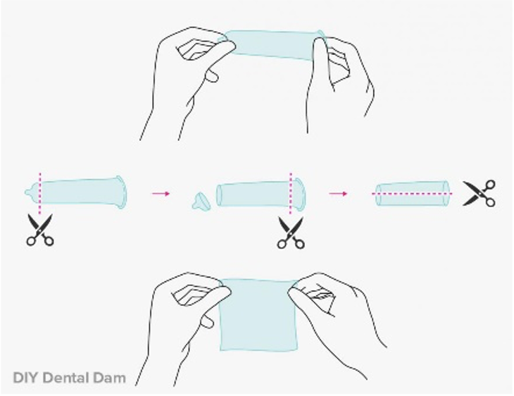#DYK that you can make a DIY dental dam out of a condom? It's just as important to use protection during oral sex as it is during penetrative sex to prevent the spread of STIs!