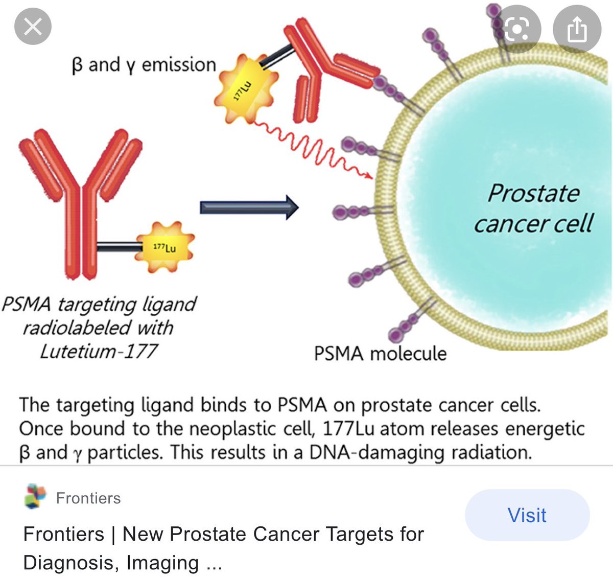 neerajaiims's tweet photo. Huge news for men with mCRPC #prostatecancer 👉Phase III VISION study with 177Lu-PSMA-617 meets primary endpoints of OS and rPFS in men with PSMA+ mCRPC “AFTER” prior Rx with Taxane &amp; AR inhibitor. https://t.co/r2VdiCnXf2 @OncoAlert @urotoday https://t.co/eH1jtd3jz0