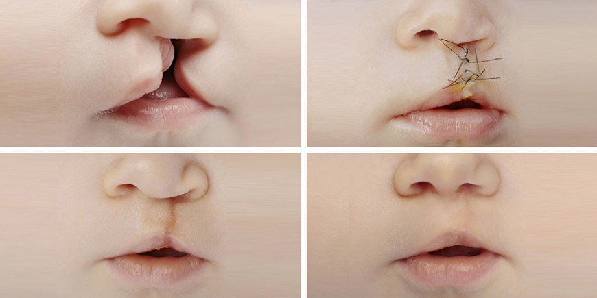 Le Vieux Tchapalo ® tweet media