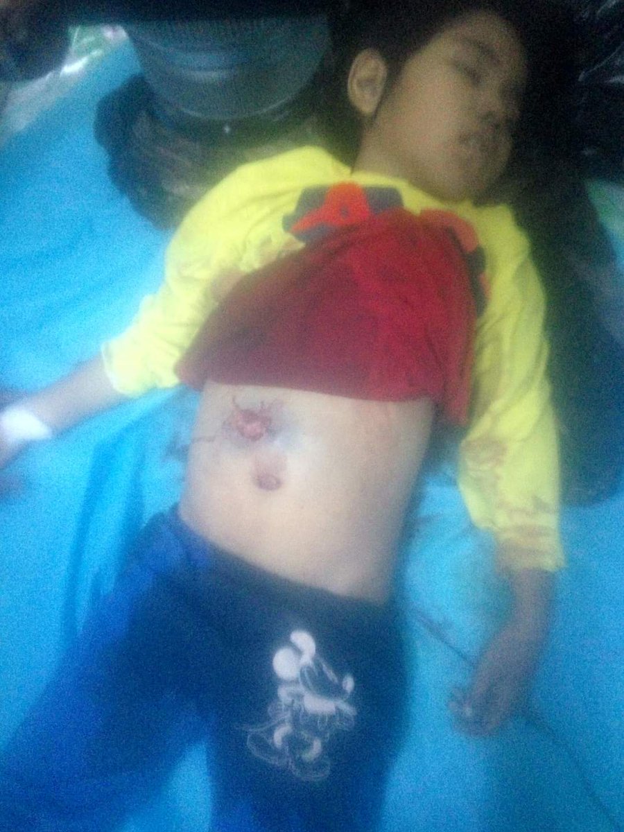 PanPan47152043's tweet photo. At least three people, including a 7-year-old girl, were killed in a shootout in Mandalay's Chan Mya Thar Si Township on March 23. On March 23, at around 5 pm, Aung Ban Lay Ward, Seven-year-old Khin Myo Chit was shot in the abdomen when soldiers and police stormed . https://t.co/4qH7hmLhum