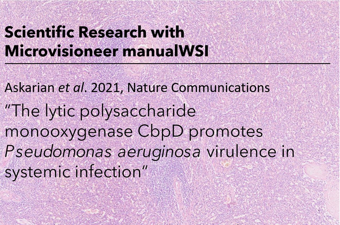 We are proud the Microvisioneer manualWSI software has been used to create new data that are part of a comprehensive novel study just published in Nature Communications.
microvisioneer.com/post/cbpd-pseu…
#science #digitalpathology #microscopy