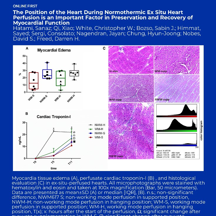 asaiojournal's tweet photo. #OnlineFirst The Position of the Heart During Normothermic Ex Situ Heart Perfusion is an Important Factor in Preservation and Recovery of Myocardial Function
https://t.co/YjokVy0g0b
@sanaz_hatami @UAlbertaSurgery @UAlberta_FoMD @CNTRP
#HeartPerfusion #HeartTx https://t.co/NXjByyfuLN