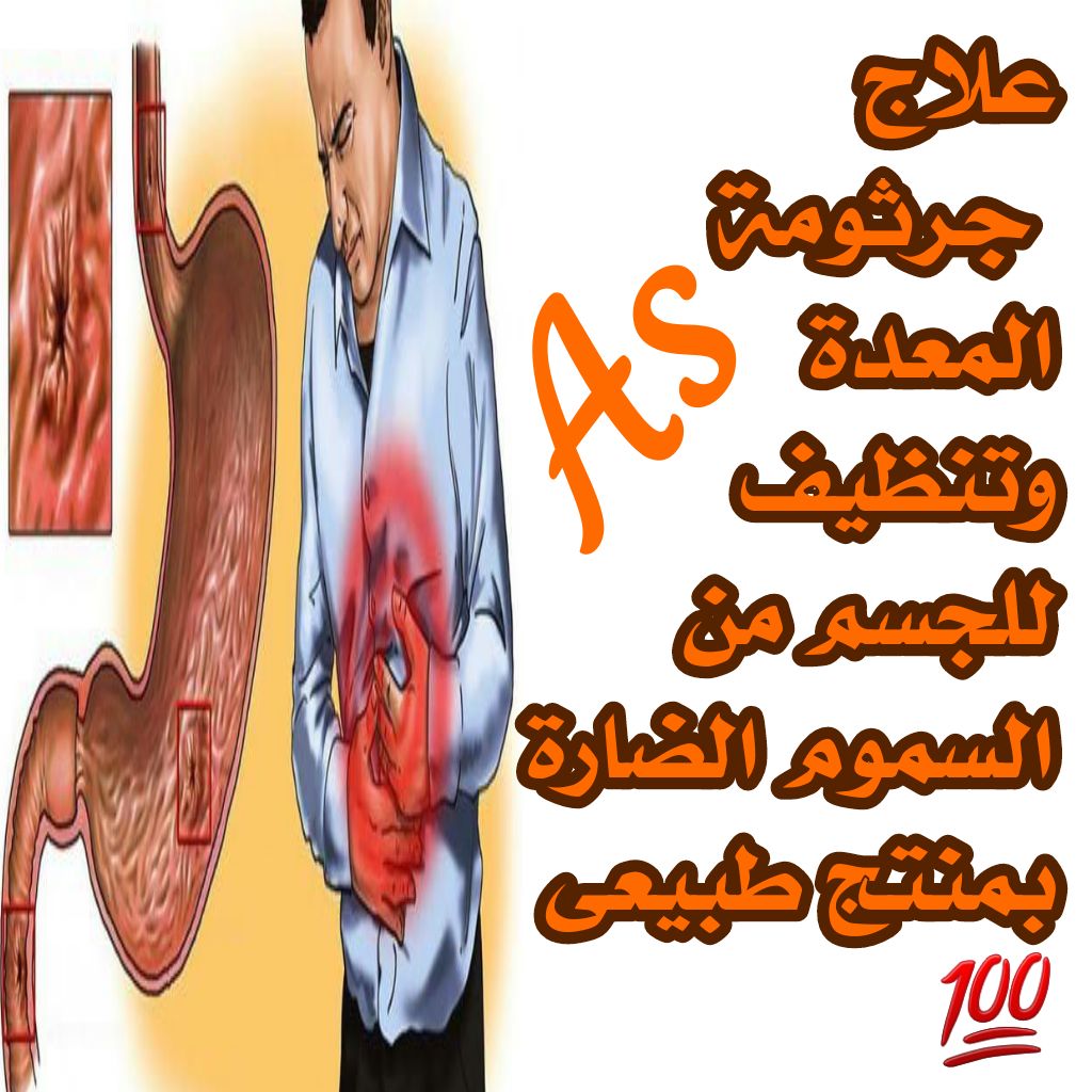#اختبارات_الرخصه_المهنيه

حل مشاكل المعده ب منتج طبيعي مليووون نبالميه واااامن ومرخص من هيئات الغذاء والدواء ومن الصحة
وحاصل على اكثر من ١٦٠ ترخيص لكل دوله 😍😍