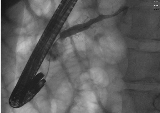 Indiana University Gastroenterology and Hepatology tweet media