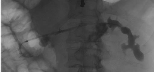 Indiana University Gastroenterology and Hepatology tweet media