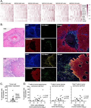 jitcancer's tweet photo. New #JITC article: Chimeric antigen receptor engineered NK cellular immunotherapy overcomes the selection of T-cell escape variant cancer cells @MaxwellYLee https://t.co/0hItazOgM4 https://t.co/jnV8ESUiFK